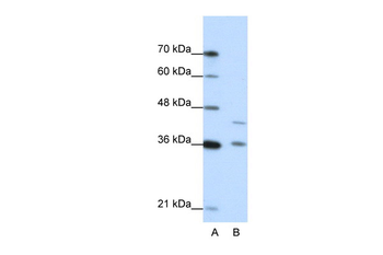 NKD2 Rabbit Polyclonal Antibody