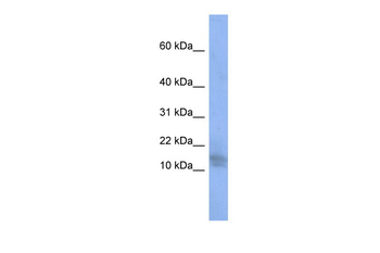 BRWD1 Rabbit Polyclonal Antibody