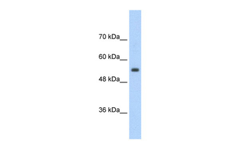 SLC13A3 Rabbit Polyclonal Antibody