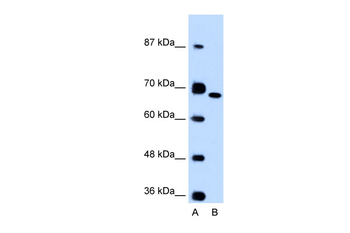 FN1 Rabbit Polyclonal Antibody