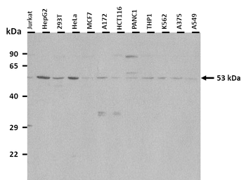 LBP Rabbit Polyclonal Antibody