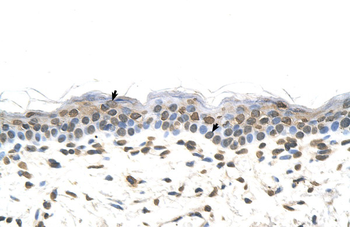 FTCD Rabbit Polyclonal Antibody