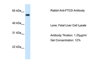 FTCD Rabbit Polyclonal Antibody