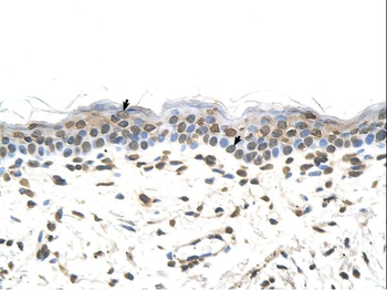 FTCD Rabbit Polyclonal Antibody