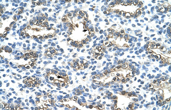 KRT13 Rabbit Polyclonal Antibody