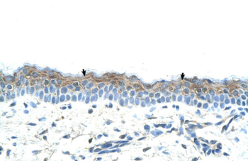 SERPINB5 Rabbit Polyclonal Antibody