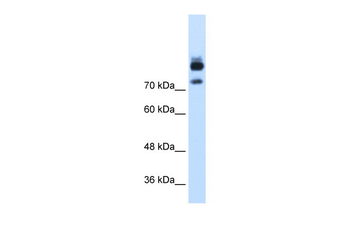 MTMR1 Rabbit Polyclonal Antibody
