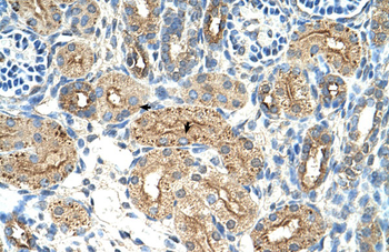 CTDSPL Rabbit Polyclonal Antibody