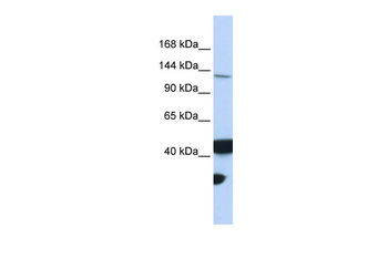 MLH3 Rabbit Polyclonal Antibody