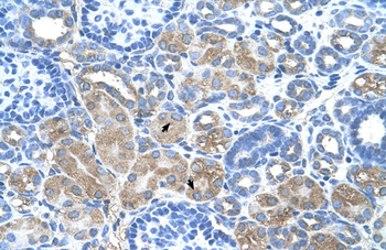 DCUN1D1 Rabbit Polyclonal Antibody
