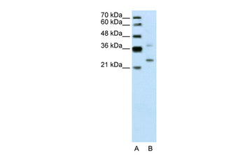 DCUN1D1 Rabbit Polyclonal Antibody