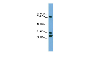 DNAI2 Rabbit Polyclonal Antibody