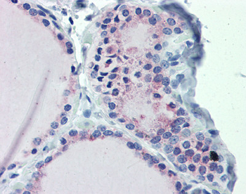 GNAS Rabbit Polyclonal Antibody