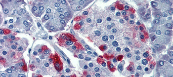GNAS Rabbit Polyclonal Antibody