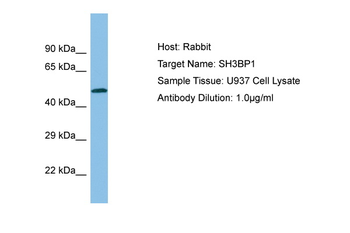 TBXA2R Rabbit Polyclonal Antibody
