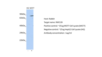 RNF139 Rabbit Polyclonal Antibody