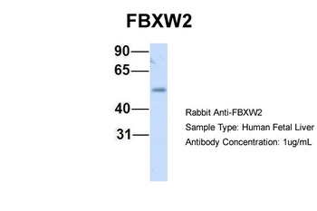 FBXW2 Rabbit Polyclonal Antibody