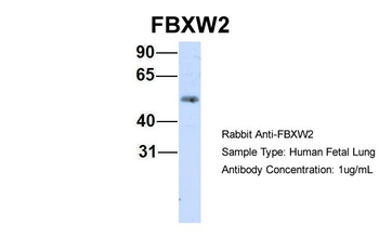 FBXW2 Rabbit Polyclonal Antibody