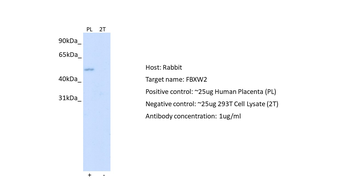 FBXW2 Rabbit Polyclonal Antibody