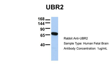 UBR2 Rabbit Polyclonal Antibody