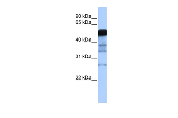 RAD18 Rabbit Polyclonal Antibody