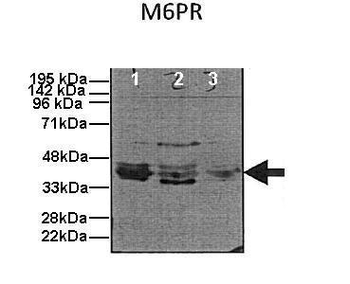 M6PR Rabbit Polyclonal Antibody