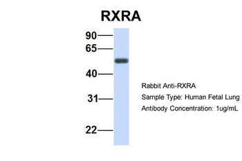 RXRA Rabbit Polyclonal Antibody