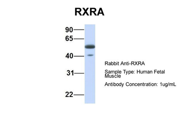 RXRA Rabbit Polyclonal Antibody