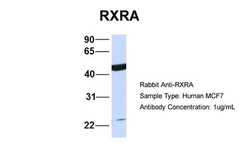 RXRA Rabbit Polyclonal Antibody