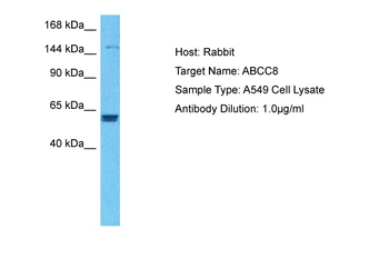 ABCC8 Rabbit Polyclonal Antibody