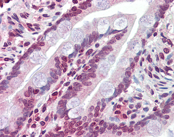 ABCC8 Rabbit Polyclonal Antibody