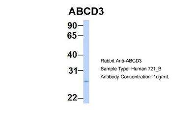 ABCD3 Rabbit Polyclonal Antibody