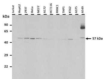 CYP46A1 Rabbit Polyclonal Antibody