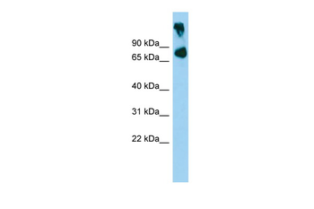 Abcb8 Rabbit Polyclonal Antibody