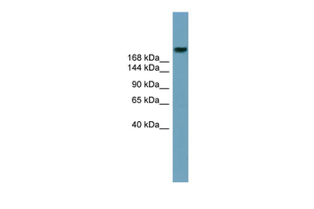 ABCA12 Rabbit Polyclonal Antibody