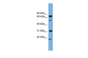 SLC6A3 Rabbit Polyclonal Antibody