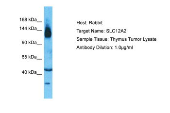 SLC12A2 Rabbit Polyclonal Antibody
