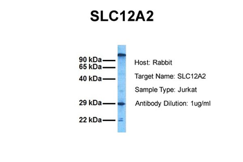SLC12A2 Rabbit Polyclonal Antibody