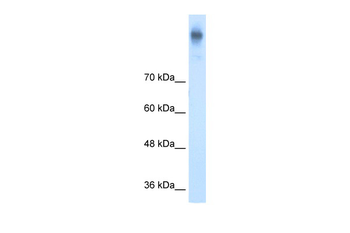 SLC12A2 Rabbit Polyclonal Antibody