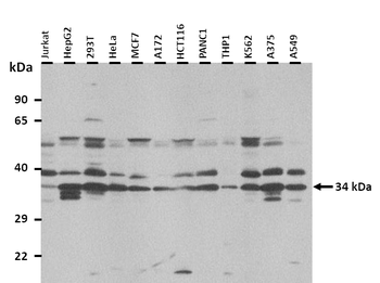 SLC25A38 Rabbit Polyclonal Antibody