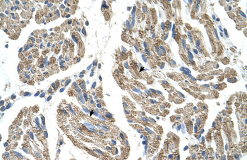 SLC25A38 Rabbit Polyclonal Antibody