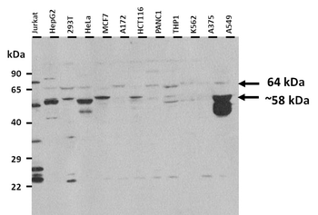 SLC24A6 Rabbit Polyclonal Antibody