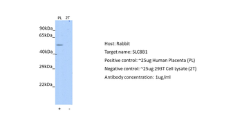 SLC24A6 Rabbit Polyclonal Antibody