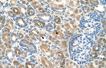 SLC22A16 Rabbit Polyclonal Antibody