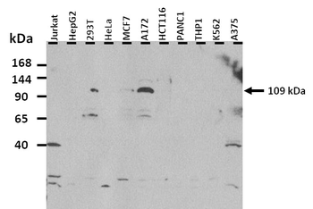 SLC26A8 Rabbit Polyclonal Antibody