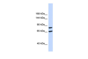 SLC26A8 Rabbit Polyclonal Antibody