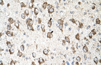 SLC26A8 Rabbit Polyclonal Antibody