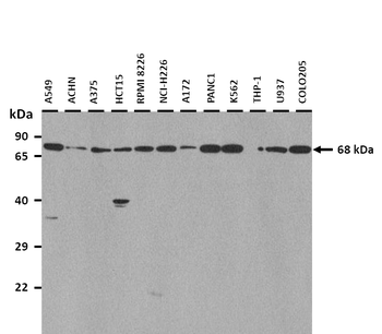 SLC39A4 Rabbit Polyclonal Antibody