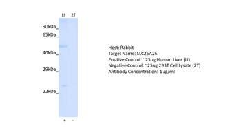 SLC25A26 Rabbit Polyclonal Antibody