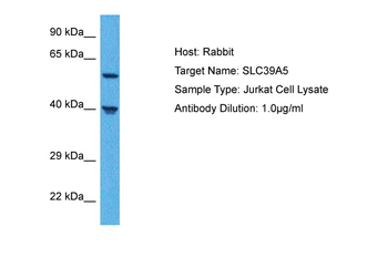 SLC39A5 Rabbit Polyclonal Antibody